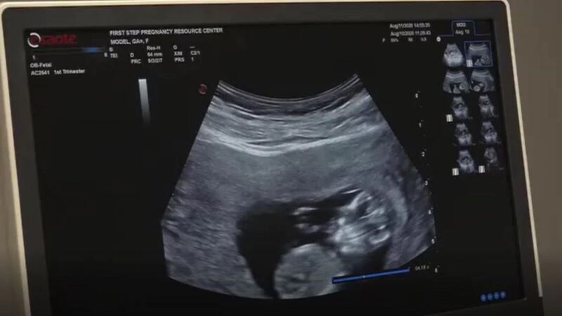 Julie Smith, with the Sentara RMH Family Birthing Center, said 10 to 25 percent of all...
