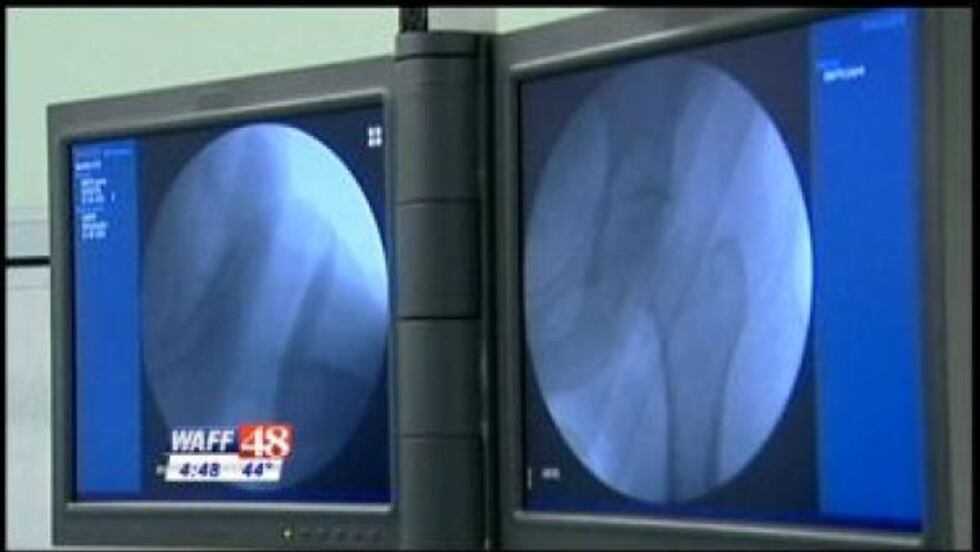 Huntsville Hospital was ranked as one of the highest rated hospitals in the nation for knee...