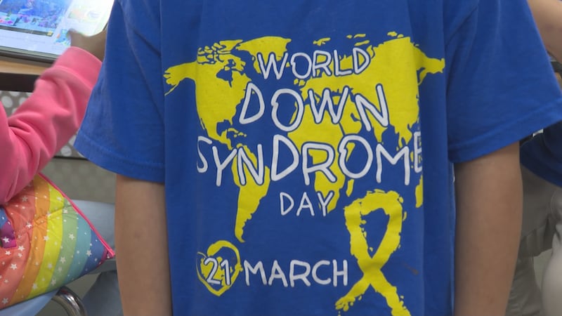Mar. 21 marked World Down Syndrome Day, a day that celebrates our friends and loved ones who...